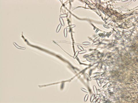 Colletotrichum_fioriniae_1