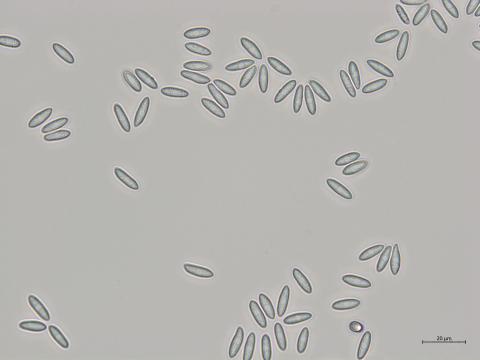Colletotrichum_fioriniae_2