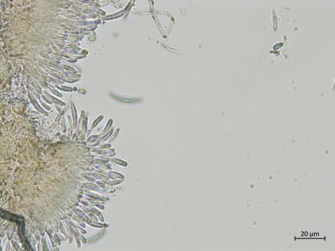 Colletotrichum_incanum_1