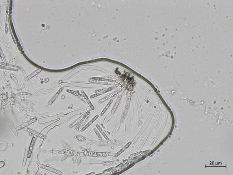 Coleophoma_empetri_1