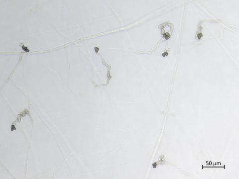 Colletotrichum_coccodes_1