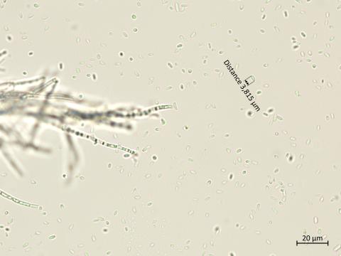 Phaeoacremonium_minimum_9
