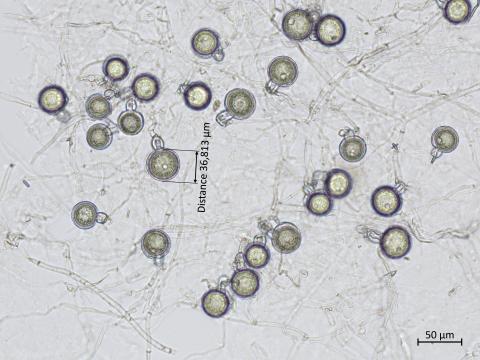 Phytophthora_erythroseptica_5