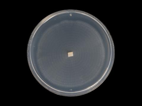 Plectosphaerella_cucumerina_10