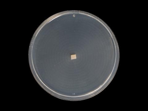 Plectosphaerella_cucumerina_11