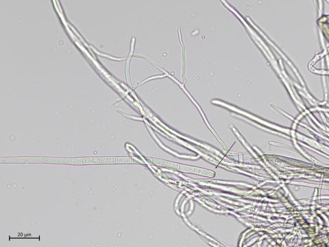Cercospora_sp_2