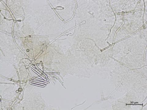 Calonectria_sp_3