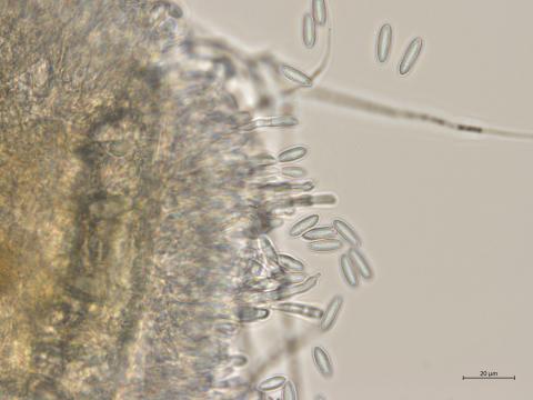 Colletotrichum_sp_4