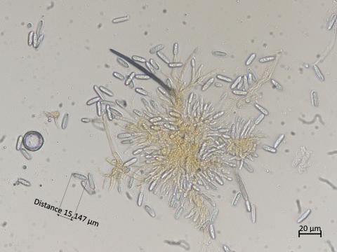 Colletotrichum_sp_7