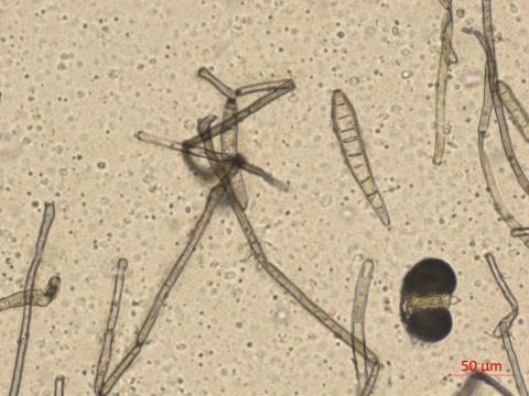 Corynespora_sp_1