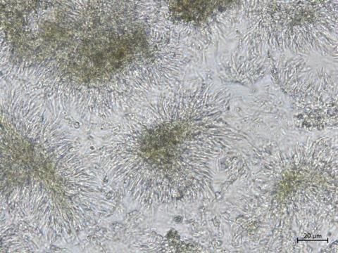 Cytospora_sp_3