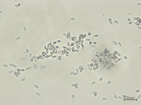 Diaporthe_sp_5