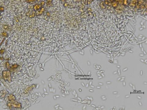 Elsinoe_ampelina_10