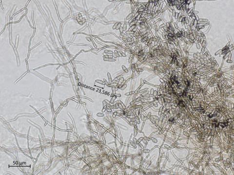 Fulvia_fulva_7