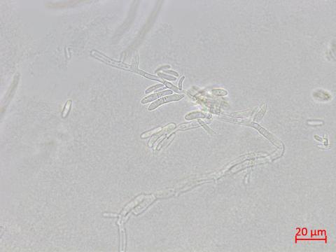 Fusarium_proliferatum_1