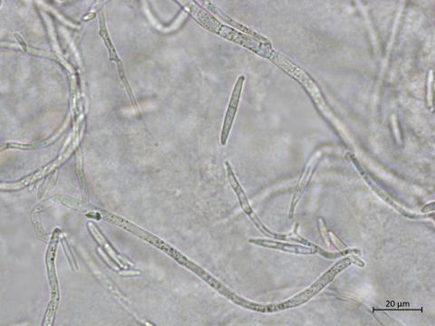 Fusarium_proliferatum_2
