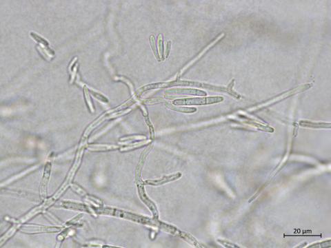 Fusarium_proliferatum_3