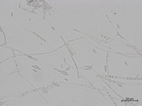 Fusarium_sporotrichioides_2