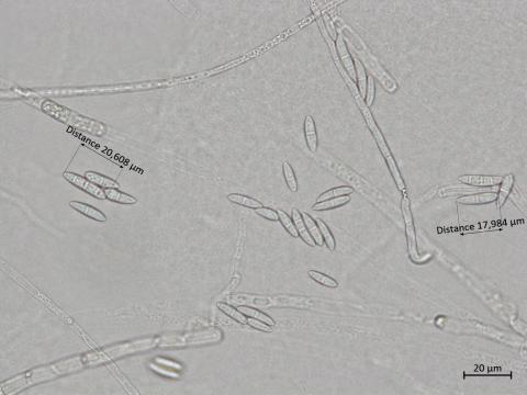 Fusarium_sporotrichioides_3