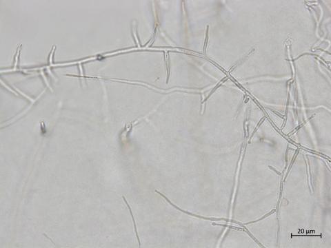 Phaeoacremonium_fraxinopennsylvanicum_3