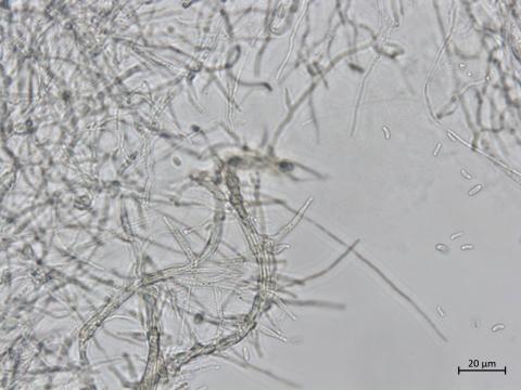 Phaeoacremonium_fraxinopennsylvanicum_1