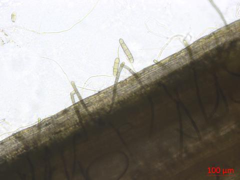 Pyrenophora_teres_1