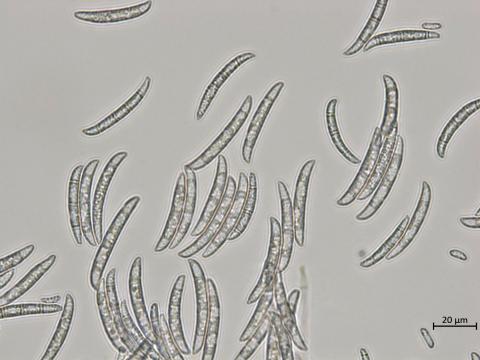 Neocosmospora_pisi_1